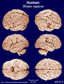 Whole brain image