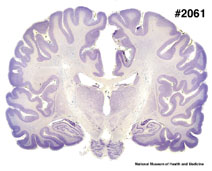 Brain section image