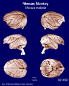 Whole brain image