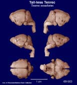 Whole brain image
