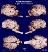 Whole brain image
