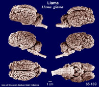 Whole brain image