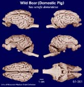 Whole brain image