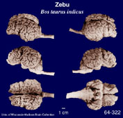 Whole brain image