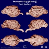Whole brain image