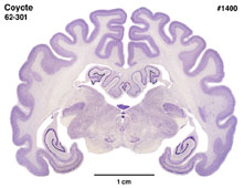 Brain section image