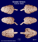 Whole brain image
