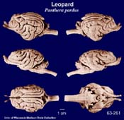 Whole brain image