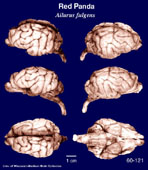 Whole brain image