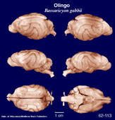 Whole brain image