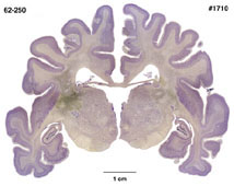 Brain section image
