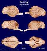 Whole brain image