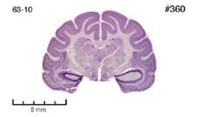 Brain section image