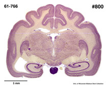 Brain section image