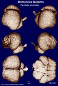 Whole brain image