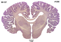 Brain section image