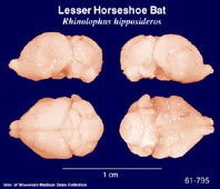 Whole brain image