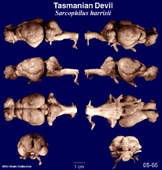 Whole brain image