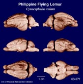 Whole brain image