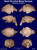 Whole brain image