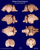 Whole brain image