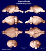 Whole brain image