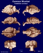 Whole brain image