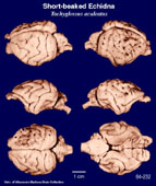 Whole brain image