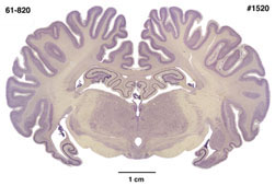 Brain section image