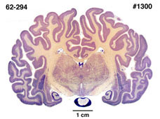 Brain section image