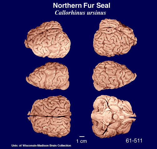 Whole brain image