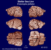 Whole brain image
