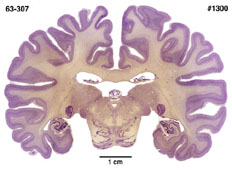 Brain section image