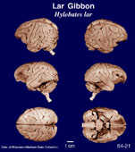 Brain section image