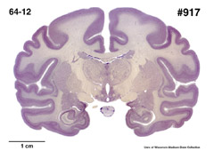Brain section image