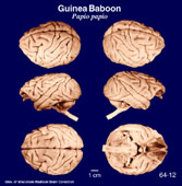 Whole brain image