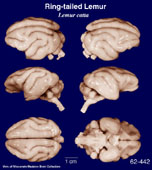 Whole brain image