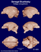 Whole brain image