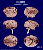 Whole brain image