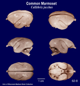 Whole brain image
