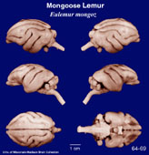 Whole brain image