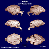 Whole brain image