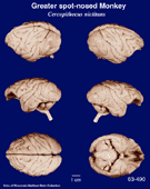 Whole brain image