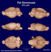 Whole brain image