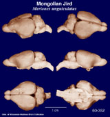 Whole brain image