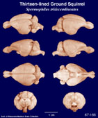 Whole brain image