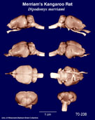 Whole brain image
