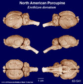 Whole brain image