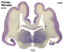 Brain section image