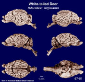 Whole brain image
